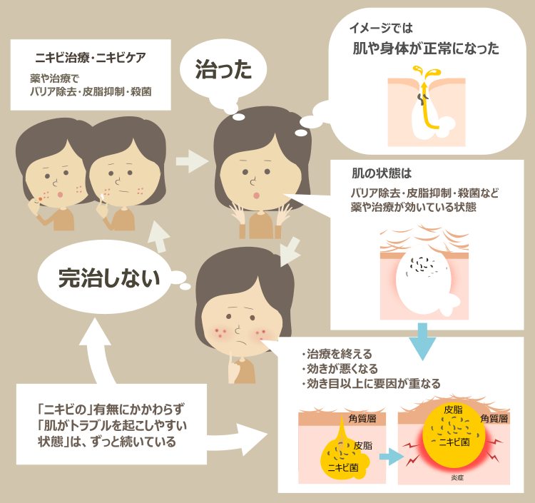 ニキビ治療の効果への誤解と、ニキビが繰り返される理由