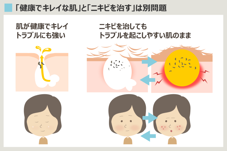 健康な肌とニキビを治しただけの肌