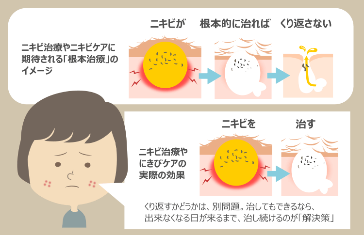 ニキビ治療は対症療法であり、根本治療ではない