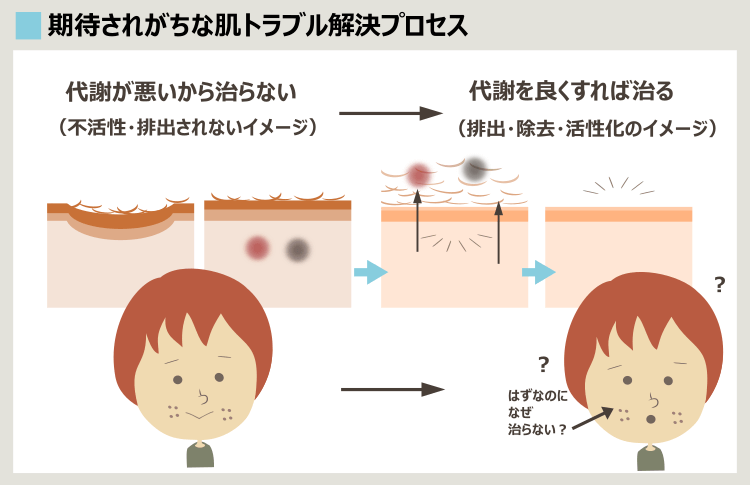 イソトレチノインとニキビ痕治療に多い誤解