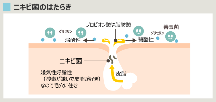 毛穴が正常な肌のニキビ菌は善玉菌