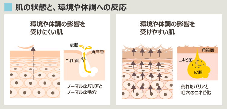 更年期のホルモンバランス変動の影響を受ける肌