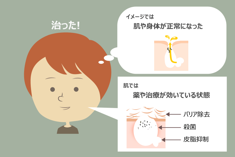 イソトレチノインの効果と健康な肌