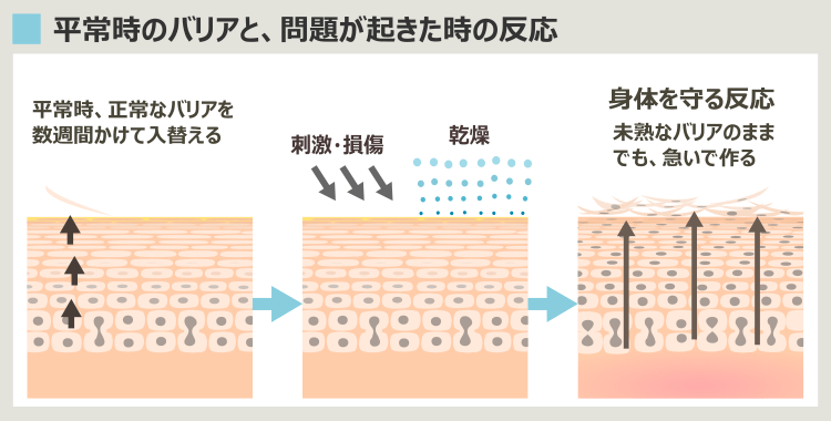 肌のバリア機能の解説