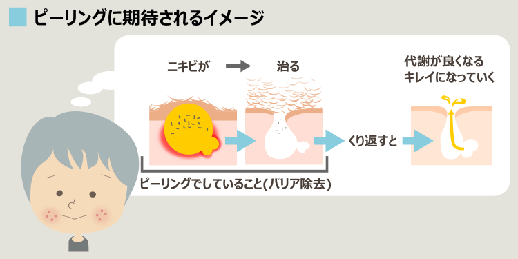 誤解の多いピーリングのイメージ