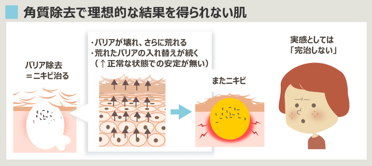 角質を除去する美容のデメリット